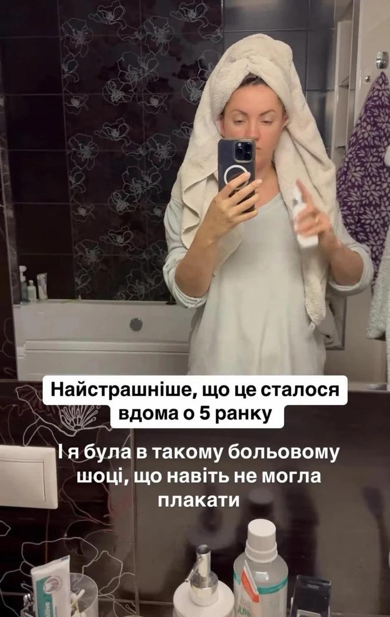 Оля Цибульська отримала синці / Скріншот Instagram Оля Цибульська отримала синці / Скріншот Instagram
