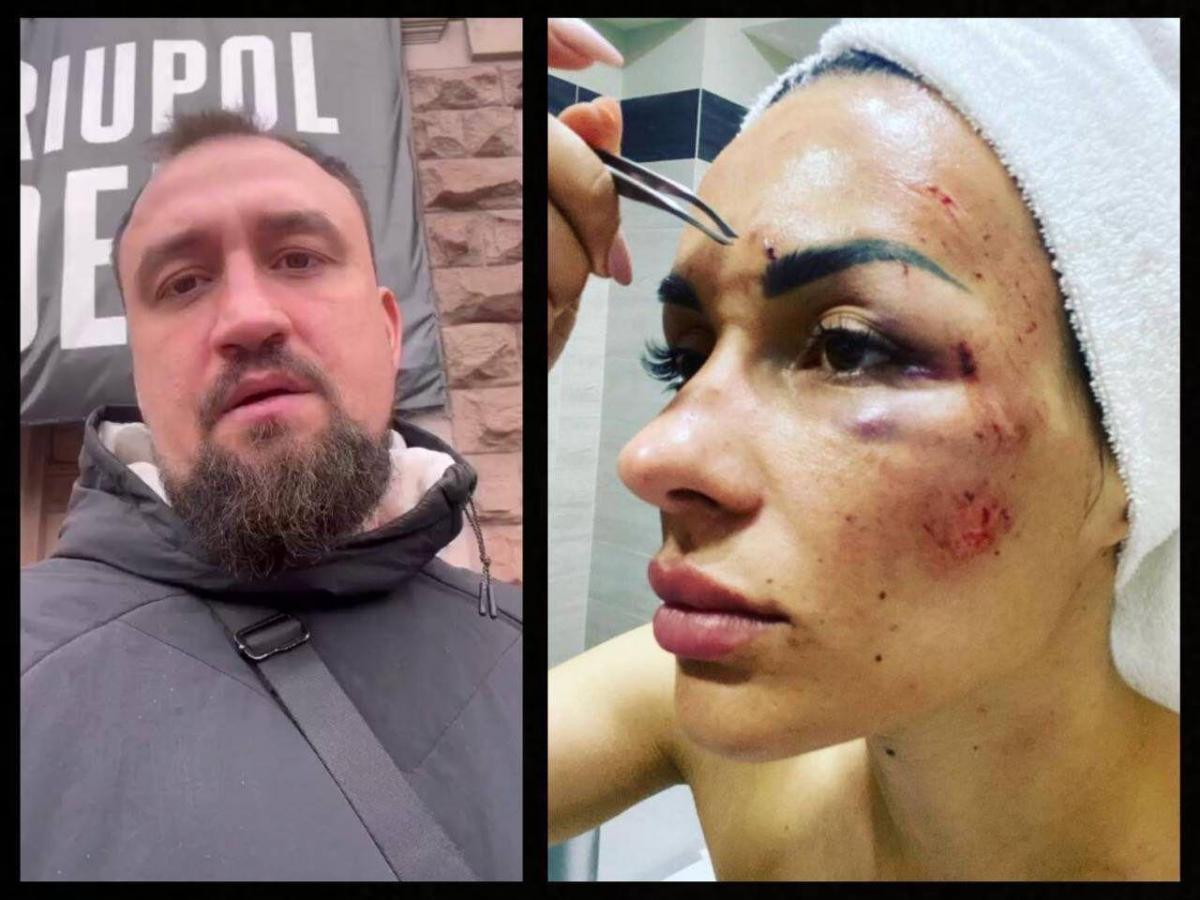 Колишня дружина волонтера Кошельника звинуватила його в розтраті волонтерських коштів Колишня дружина волонтера Кошельника звинуватила його в розтраті волонтерських коштів