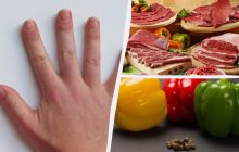 Що корисно для нігтів: дієтологи назвали найкращі продукти