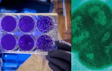 Выдерживает экстремальный уровень радиации: ученые рассказали о самой "живучей" бактерии