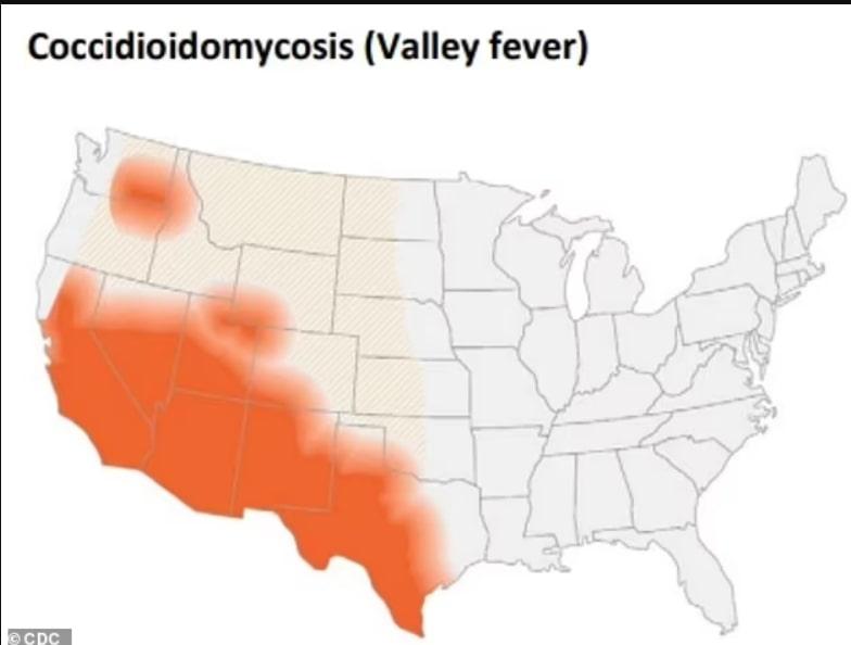 Карта поширення кокцидіомікозу в США