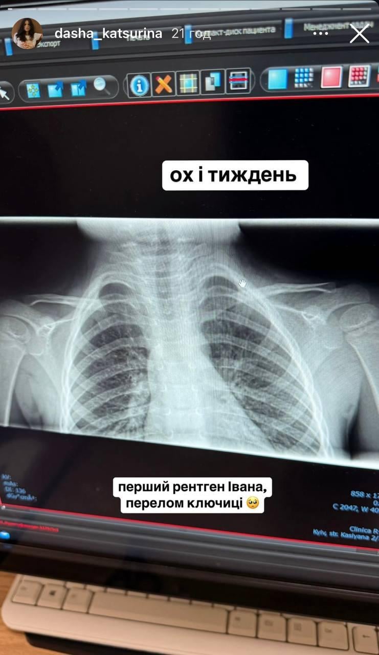Скріншот сторіз Даші Кацуріної Скріншот сторіз Даші Кацуріної