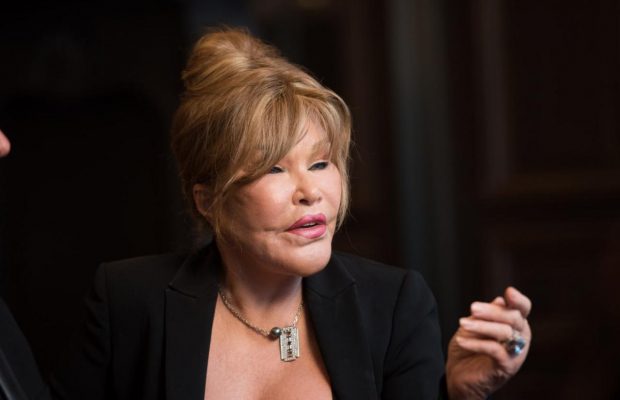 Померла "жінка-кішка" Джоселін Вільденштайн, яка за життя зробила 80 пластичних операцій