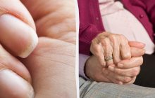 Що нігті говорять про ваше здоров'я: за ними можна передбачити тривалість життя