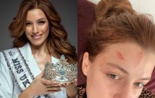 "Мисс Вселенная Украины" шокировала фото после избиения мужем: "Я стала сильней"