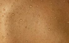 Ученые создали "суперкожу", которая восстанавливается после пореза всего за 24 часа