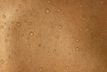 Учені створили супершкіру, яка відновлюється після порізу лише за 24 години