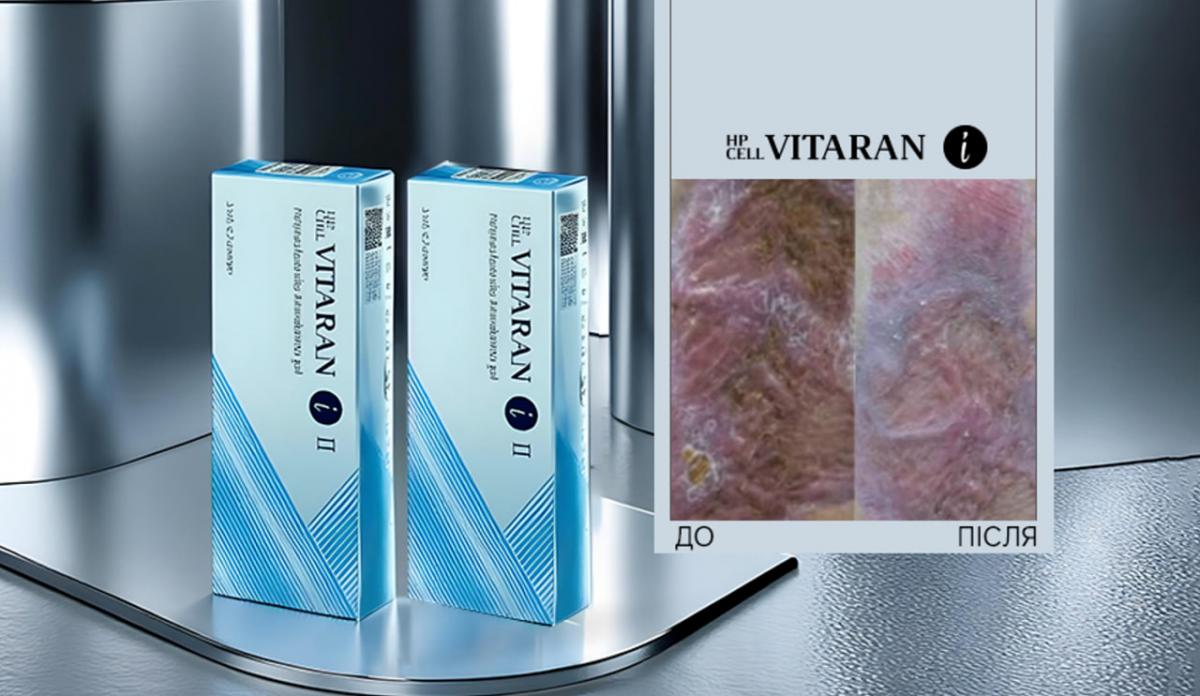 Ярослав Лата на сайте EMET поделился опытом об использовании HP Cell Vitaran при лечении ожоговых травм у военнослужащих Ярослав Лата на сайте EMET поделился опытом об использовании HP Cell Vitaran при лечении ожоговых травм у военнослужащих