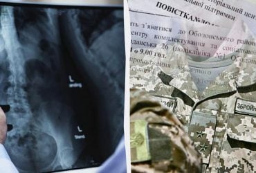 З якими хворобами хребта не мобілізують: адвокат вказала на нюанси