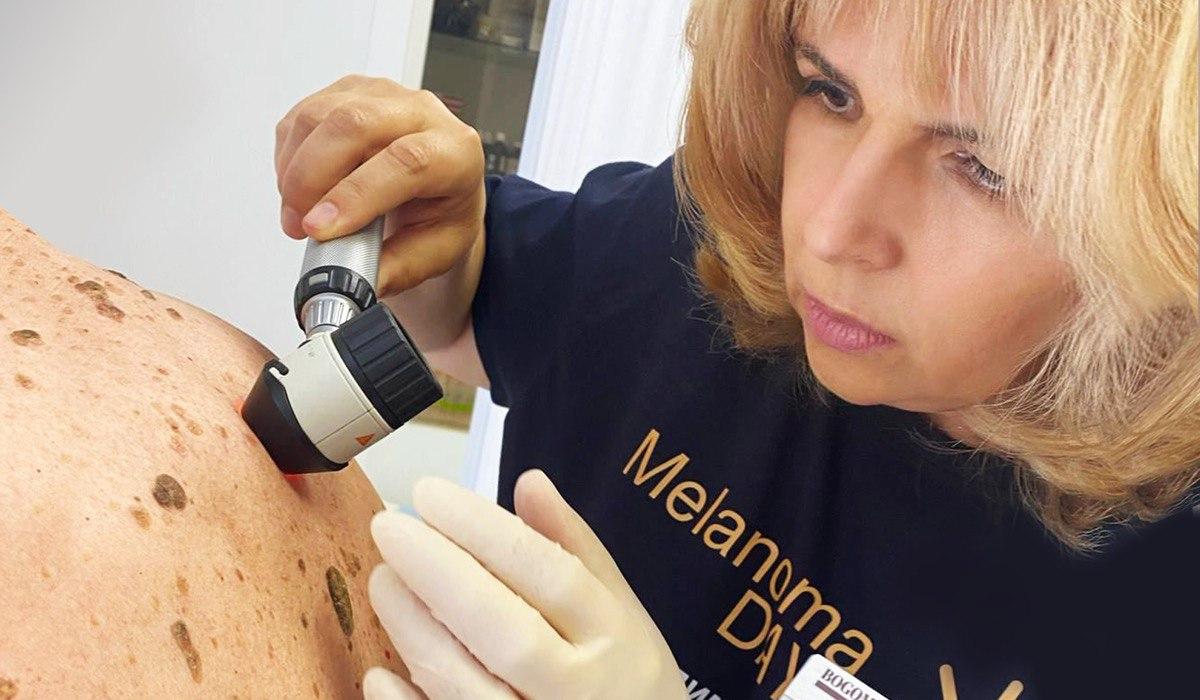 Всеукраїнський День діагностики меланоми Всеукраїнський День діагностики меланоми