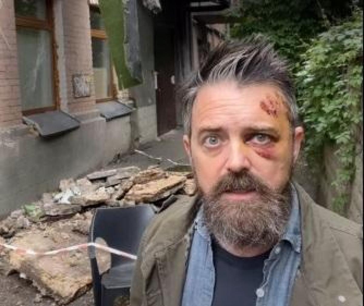 В Киеве в результате обвала балкона пострадал американский режиссер