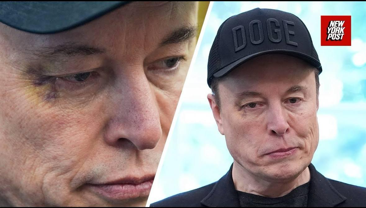 Ілон Маск прийшов у Білий дім із синцем / скриншот New York Post Ілон Маск прийшов у Білий дім із синцем / скриншот New York Post
