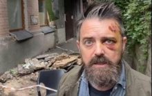 В Киеве в результате обвала балкона пострадал американский режиссер (видео)