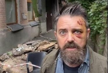 В Киеве в результате обвала балкона пострадал американский режиссер (видео)