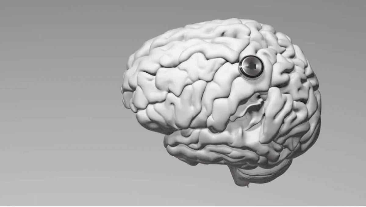 Китай присоединяется к США в гонке за мозговыми имплантатами / фото Neuralink Китай присоединяется к США в гонке за мозговыми имплантатами / фото Neuralink