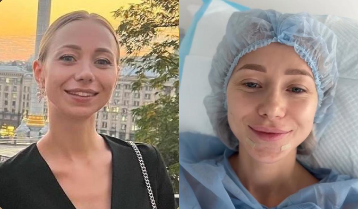 Жена Виктора Павлика сделала новую пластическую операцию / коллаж УНИАН, скриншоты Жена Виктора Павлика сделала новую пластическую операцию / коллаж УНИАН, скриншоты