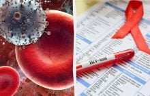 Прорив у пошуках ліків від ВІЛ: вчені досягли раніше неможливого