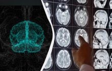Прорыв в лечении болезни Альцгеймера: ученые сделали неожиданное открытие