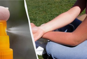 Що робити, якщо ви отримали сонячний опік: лікар розкрив шість дієвих порад