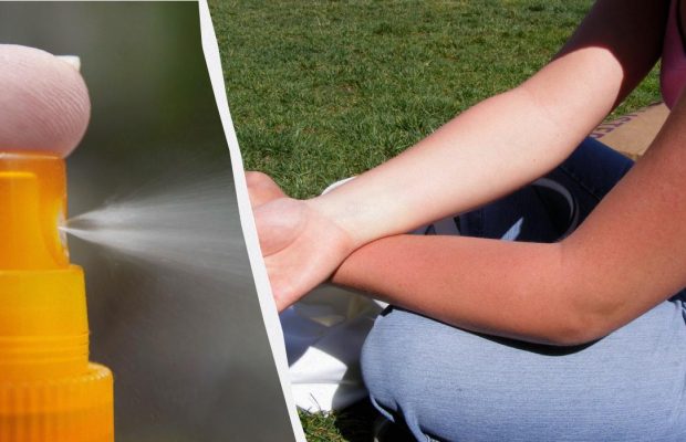 Що робити, якщо ви отримали сонячний опік: лікар розкрив шість дієвих порад