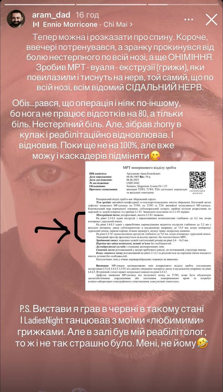 Скріншот сторіз Арама Арзуманяна Скріншот сторіз Арама Арзуманяна