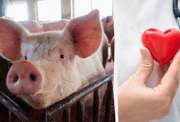 Учені вперше виростили людське серце в ембріоні свині: воно билося 21 день
