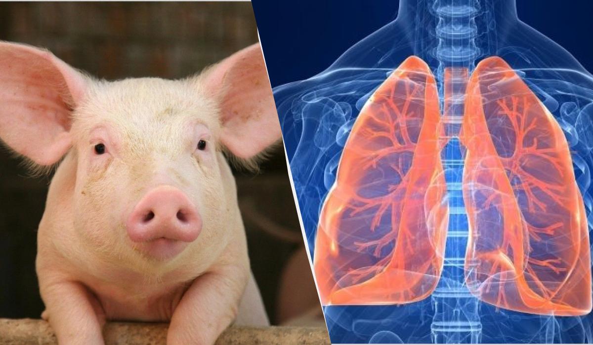 Вчені вперше провели ксенотрансплантацію легень/ Колаж УНІАН, фото sciencemag.org, onter.org Вчені вперше провели ксенотрансплантацію легень/ Колаж УНІАН, фото sciencemag.org, onter.org