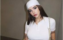 Відома українська блогерка зробила вторинну ринопластику та пояснила причину (відео)