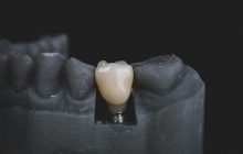 Ученые раскрыли 1500-летнюю тайну первой в истории пандемии с помощью зубов