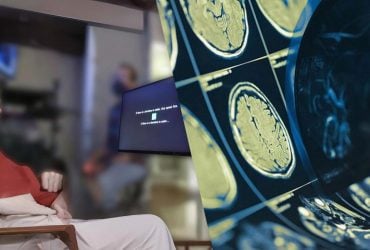 Вчені зі США створили мозковий імплант, який буквально читає думки