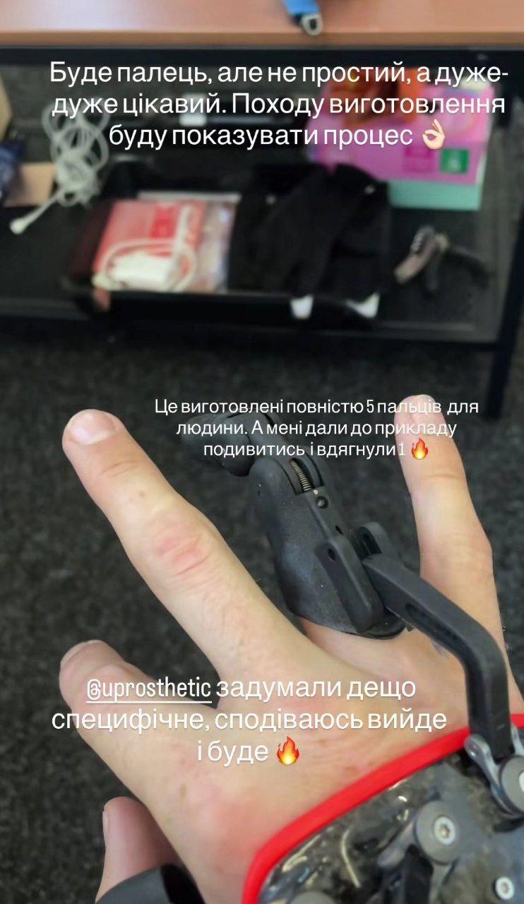 Артур Логай приміряв протез / скріншот Instagram Артур Логай приміряв протез / скріншот Instagram