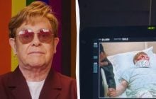 Элтон Джон напугал фанатов странным фото из больницы