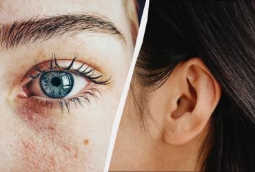 6 совершенно бесполезных человеческих органов: они не нужны организму