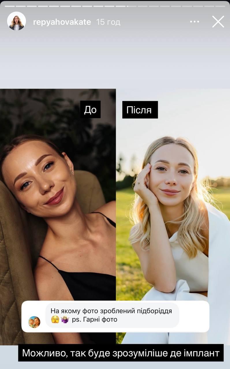 Скріншот сторіз Катерини Репяхової Скріншот сторіз Катерини Репяхової