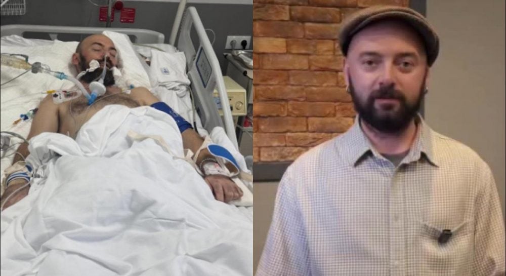 ADAM впав у кому