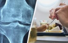 Дієтологи назвали найкращу їжу, яка допоможе зміцнити кістки після 50 років