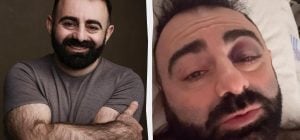 Звезду "Скаженого весілля" госпитализировали после падения в оркестровую яму (видео)