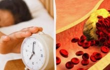 Що підвищує холестерин: дієтологи назвали одну ранкову звичку, якої треба позбутися