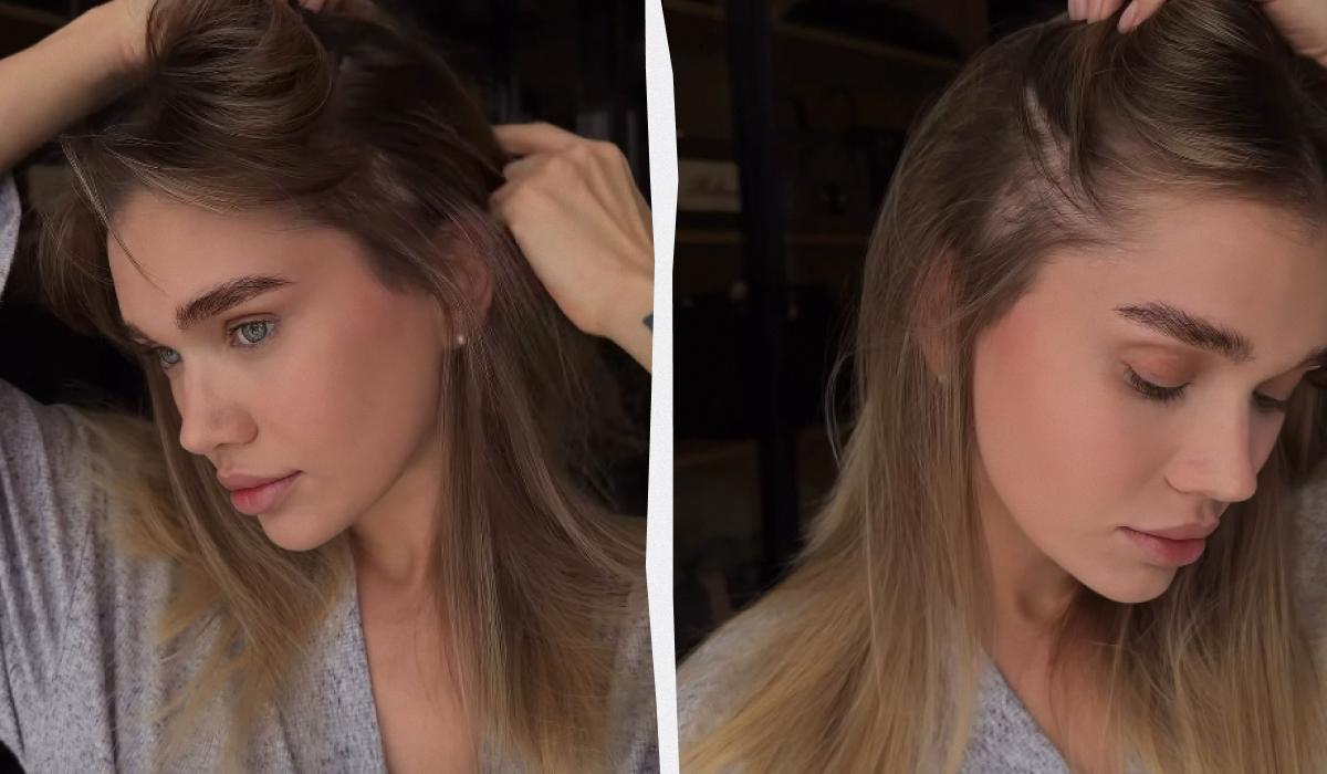 Блогерша Саша Бо заговорила о печальных последствиях подтяжки лица (фото)