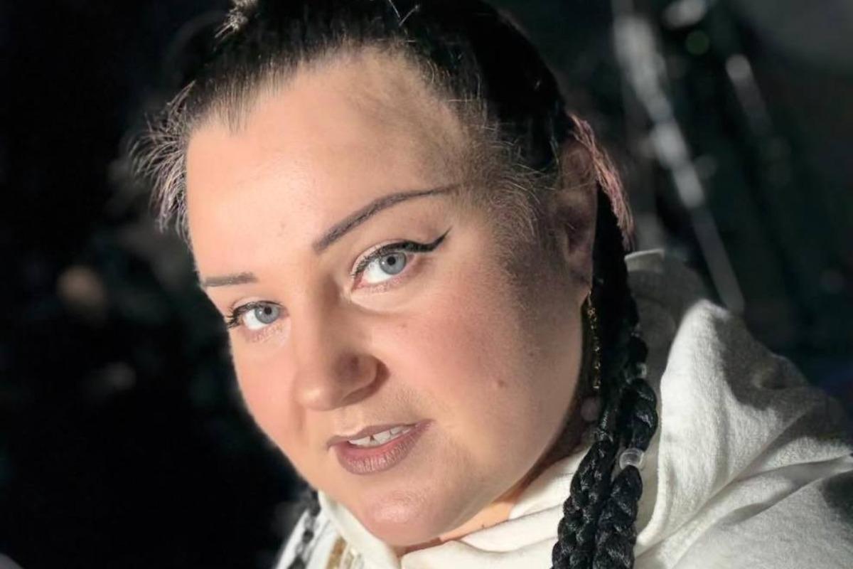 'Больно дышать': Alyona Alyona сообщила о проблемах со здоровьем