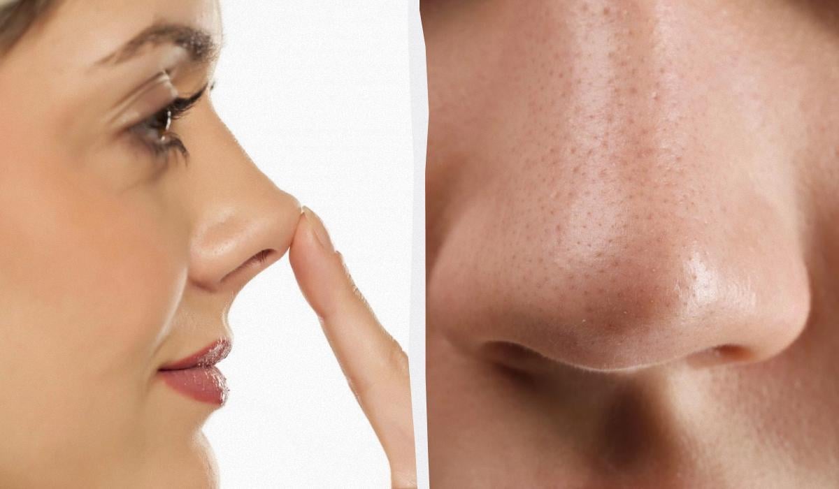 Ваш ніс – дрібниця: у одного чоловіка він був довший за олівець (фото)