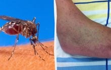 Небезпечна тропічна інфекція загрожує майже всій Європі, - The Guardian