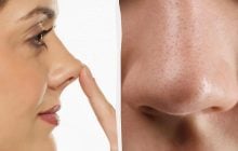 Ваш ніс – дрібниця: у одного чоловіка він був довший за олівець (фото)