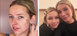 Донька Гвінет Пелтроу поскаржилася на проблеми зі шкірою: фото без макіяжу