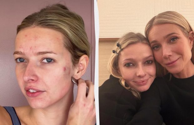 Дочь Гвинет Пэлтроу пожаловалась на проблемы с кожей: фото без макияжа