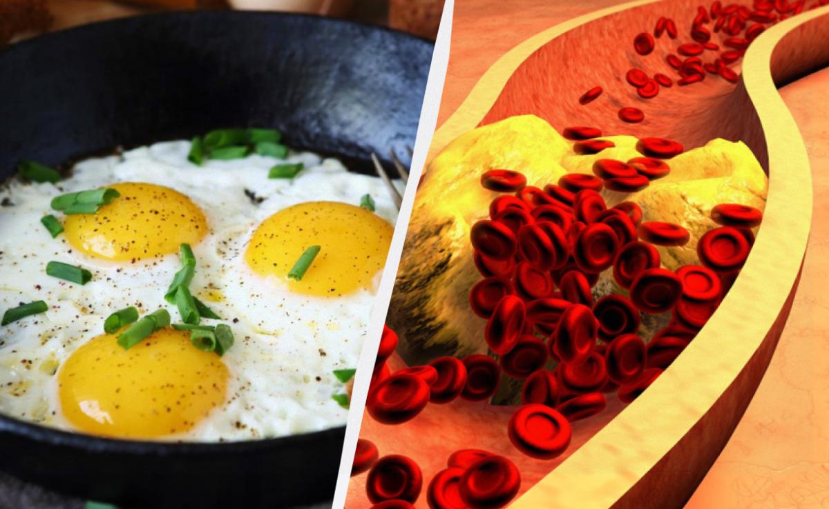 Що відбувається з вашим холестерином, якщо ви їсте яйця щодня: відповідь учених Що відбувається з вашим холестерином, якщо ви їсте яйця щодня: відповідь учених