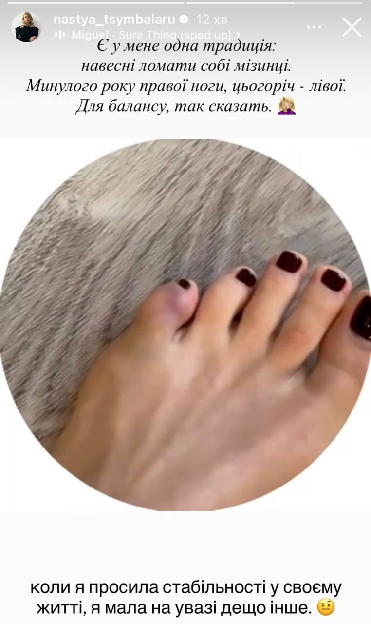 Відома українська акторка повідомила про перелом пальця