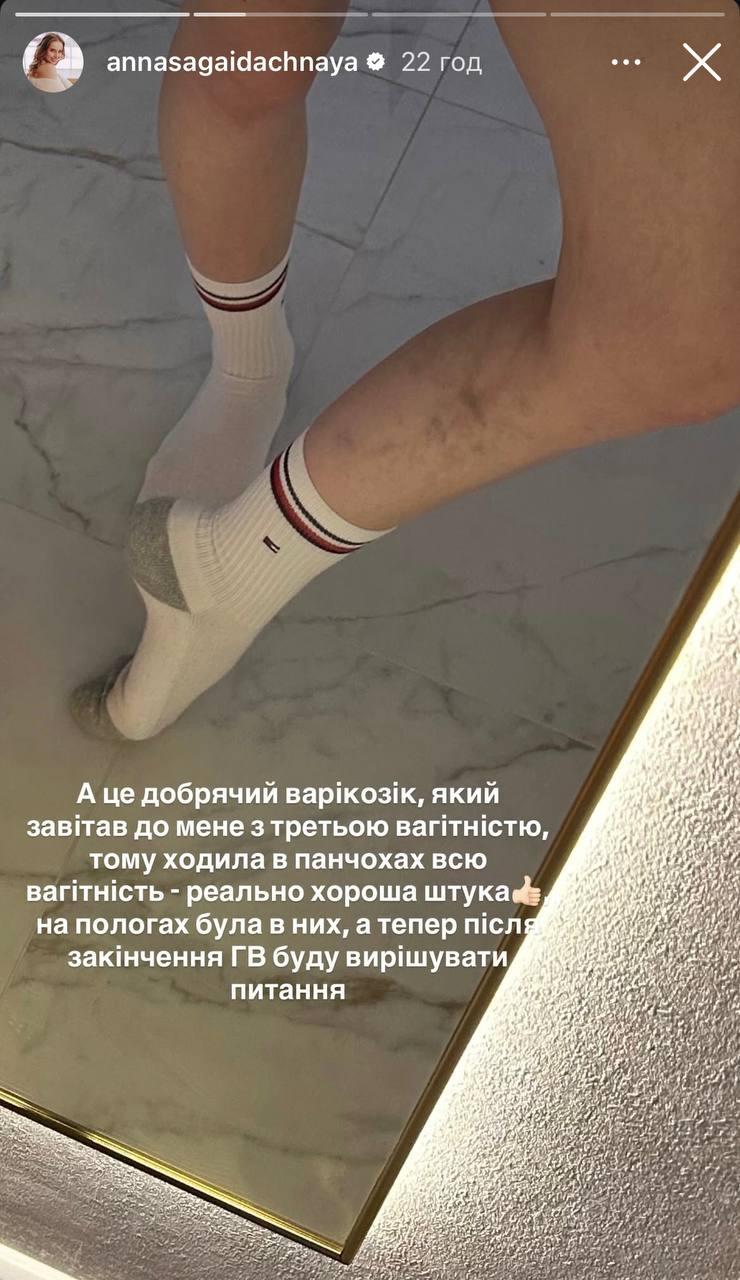 Зірка 'Кріпосної' показала свою фігуру після третіх пологів (фото)