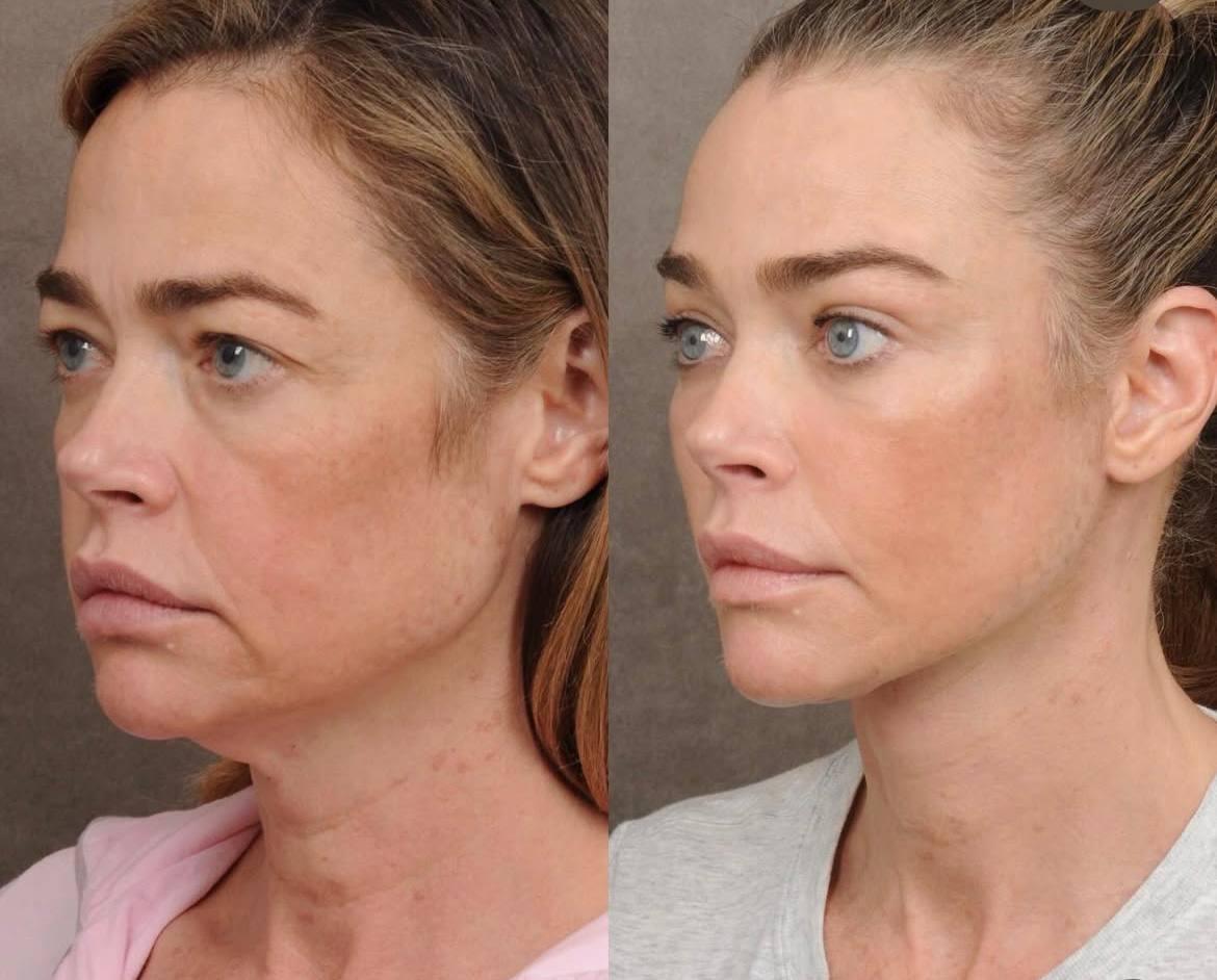 Відома американська акторка зробила підтяжку обличчя: який вигляд зараз має зірка (фото) Відома американська акторка зробила підтяжку обличчя: який вигляд зараз має зірка (фото)