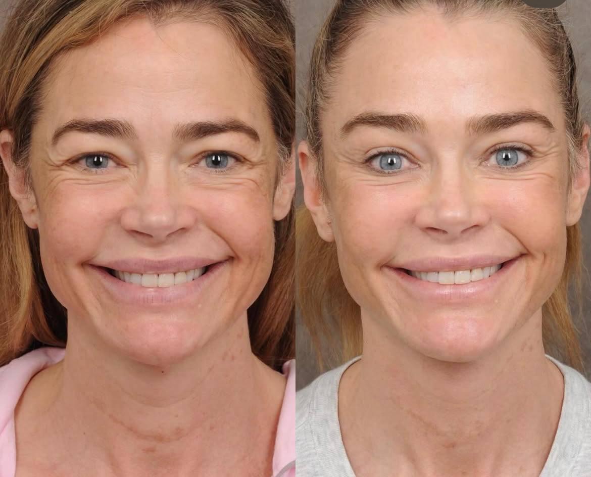 Відома американська акторка зробила підтяжку обличчя: який вигляд зараз має зірка (фото) Відома американська акторка зробила підтяжку обличчя: який вигляд зараз має зірка (фото)